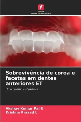 Supraviețuirea coroanei și a fațetelor în dinții anteriori ET - Sobrevivncia de coroa e facetas em dentes anteriores ET