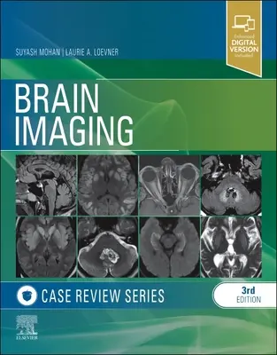 Examinarea cazurilor de imagistică cerebrală - Brain Imaging Case Review