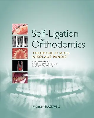 Autoligarea în ortodonție: O abordare bazată pe dovezi a biomecanicii și a tratamentului - Self-Ligation in Orthodontics: An Evidence-Based Approach to Biomechanics and Treatment
