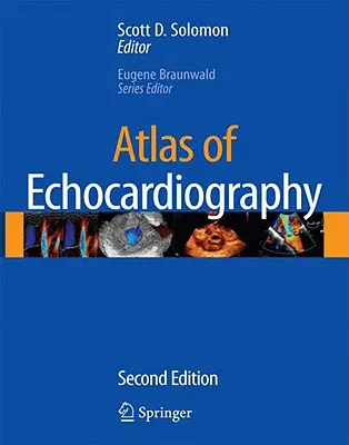 Atlas de ecocardiografie [Cu CDROM] - Atlas of Echocardiography [With CDROM]