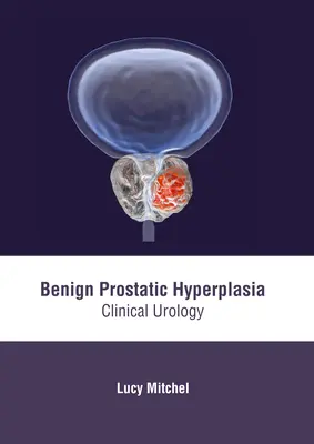Hiperplazia prostatică benignă: Urologie clinică - Benign Prostatic Hyperplasia: Clinical Urology