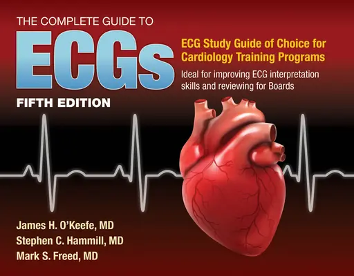Ghidul complet pentru Ecgs: A Comprehensive Study Guide to Improve ECG Interpretation Skills: Un ghid de studiu cuprinzător pentru îmbunătățirea interpretării ECG - The Complete Guide to Ecgs: A Comprehensive Study Guide to Improve ECG Interpretation Skills: A Comprehensive Study Guide to Improve ECG Interpretatio