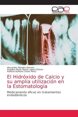 El Hidrxido de Calcio y su amplia utilizacin en la Estomatologa