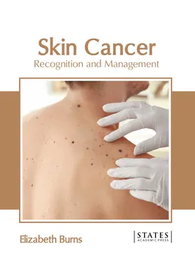 Cancerul de piele: Recunoaștere și gestionare - Skin Cancer: Recognition and Management