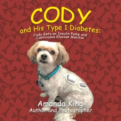 Cody și diabetul său de tip 1: Cody primește o pompă de insulină și un monitor continuu de glucoză - Cody and His Type 1 Diabetes: Cody Gets an Insulin Pump and Continuous Glucose Monitor
