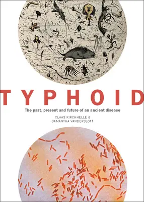 Typhoid: Trecutul, prezentul și viitorul unei boli străvechi - Typhoid: The Past, Present, and Future of an Ancient Disease