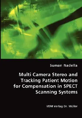 Stereo cu mai multe camere și urmărirea mișcării pacientului pentru compensare în sistemele de scanare SPECT - Multi Camera Stereo and Tracking Patient Motion for Compensation in SPECT Scanning Systems