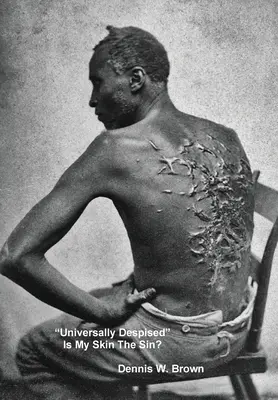 Universally Despised