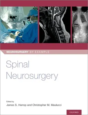 Neurochirurgie spinală - Spinal Neurosurgery