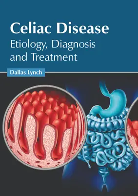 Boala celiacă: Etiologie, diagnostic și tratament - Celiac Disease: Etiology, Diagnosis and Treatment