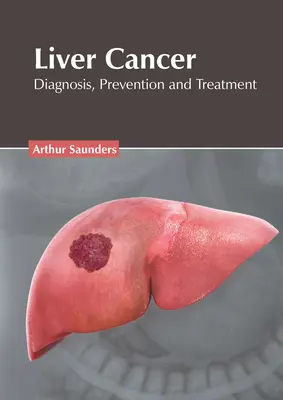 Cancerul hepatic: Diagnosis, Prevention and Treatment (Diagnostic, prevenire și tratament) - Liver Cancer: Diagnosis, Prevention and Treatment