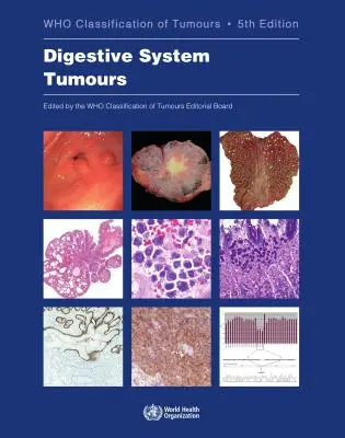 Tumorile sistemului digestiv: Clasificarea tumorilor: Who Classification of Tumors - Digestive System Tumours: Who Classification of Tumours