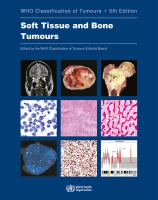 Tumorile țesuturilor moi și osoase: Who Classification of Tumors (Clasificarea tumorilor) - Soft Tissue and Bone Tumours: Who Classification of Tumours