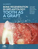 Regenerarea osoasă în implantologie - dintele ca grefă - Bone regeneration in implantology - tooth as a graft