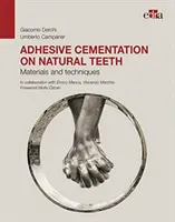 Cimentarea adezivă pe dinți naturali - Materiale și tehnici - Adhesive cementation on natural teeth - Materials and techniques