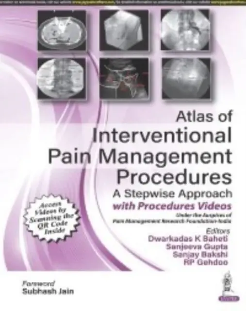 Atlasul procedurilor intervenționale de gestionare a durerii - Atlas of Interventional Pain Management Procedures