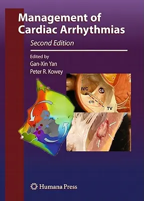 Managementul aritmiilor cardiace - Management of Cardiac Arrhythmias