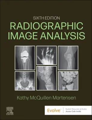Analiza imaginilor radiografice - Radiographic Image Analysis