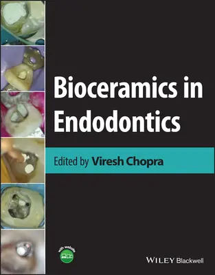 Bioceramică în endodonție - Bioceramics in Endodontics