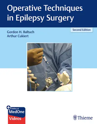 Tehnici operatorii în chirurgia epilepsiei - Operative Techniques in Epilepsy Surgery