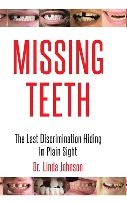 Dinți lipsă: Ultima discriminare ascunsă la vedere - Missing Teeth: The Last Discrimination Hiding in Plain Sight