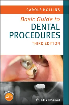 Ghid de bază pentru procedurile dentare - Basic Guide to Dental Procedures