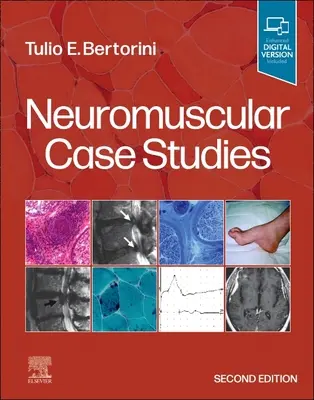Studii de caz neuromusculare - Neuromuscular Case Studies