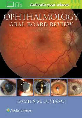 Revizuirea orală a consiliului de oftalmologie - Ophthalmology Oral Board Review
