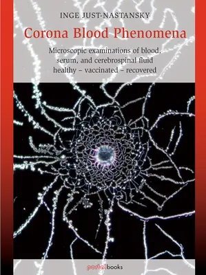 Fenomene de sânge corona: Examinări microscopice ale sângelui, serului și lichidului cefalorahidian: Sănătos - Vaccinat - Recuperat - Corona Blood Phenomena: Microscopic Examinations of Blood, Serum, and Cerebrospinal Fluid: Healthy - Vaccinated - Recovered