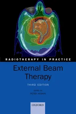 Terapie externă cu fascicule - External Beam Therapy