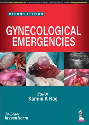 Urgențe ginecologice - Gynecological Emergencies
