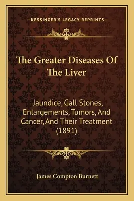 Cele mai mari boli ale ficatului: Icterul, calculii biliari, măririle, tumorile și cancerul, și tratamentul lor - The Greater Diseases Of The Liver: Jaundice, Gall Stones, Enlargements, Tumors, And Cancer, And Their Treatment