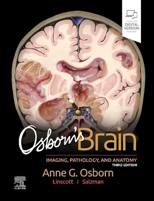 Creierul lui Osborn - Osborn's Brain