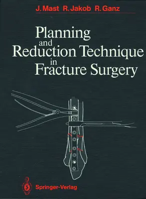 Tehnica de planificare și reducere în chirurgia fracturilor - Planning and Reduction Technique in Fracture Surgery
