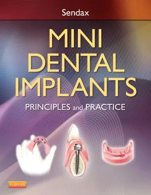 Mini-implanturi dentare: Principii și practică - Mini Dental Implants: Principles and Practice
