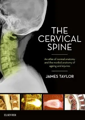 Coloana vertebrală cervicală: Un atlas al anatomiei normale și al anatomiei morbide a îmbătrânirii și a rănilor - The Cervical Spine: An Atlas of Normal Anatomy and the Morbid Anatomy of Ageing and Injuries