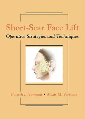 Short-Scar Face Lift: Strategii și tehnici operatorii - Short-Scar Face Lift: Operative Strategies and Techniques