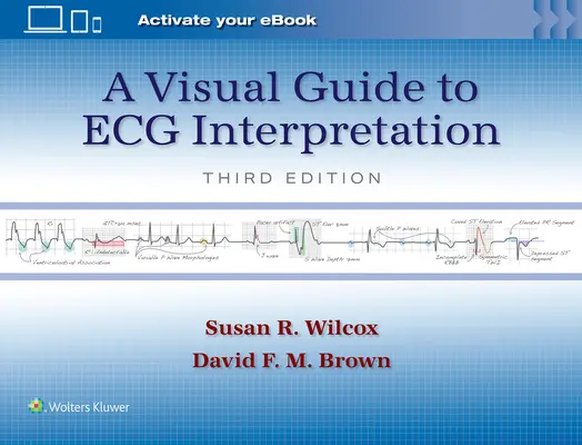Un ghid vizual pentru interpretarea ECG - A Visual Guide to ECG Interpretation