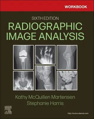 Caiet de lucru pentru analiza imaginilor radiografice - Workbook for Radiographic Image Analysis