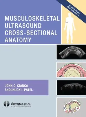 Anatomia transversală a ultrasunetelor musculo-scheletice - Musculoskeletal Ultrasound Cross-Sectional Anatomy
