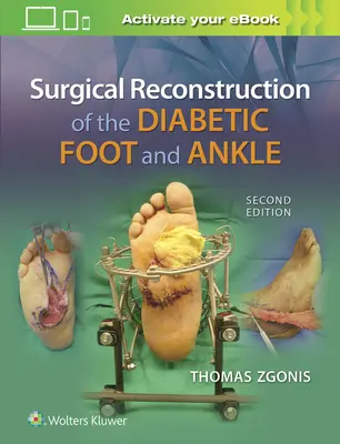 Reconstrucția chirurgicală a piciorului și gleznei diabetice - Surgical Reconstruction of the Diabetic Foot and Ankle