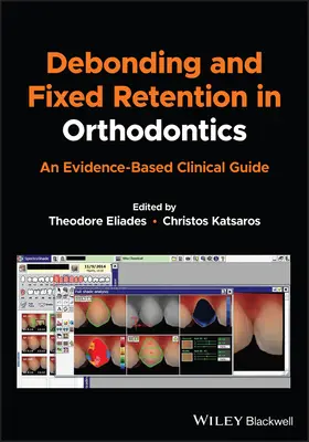 Debondarea și retenția fixă în ortodonție: Un ghid clinic bazat pe dovezi - Debonding and Fixed Retention in Orthodontics: An Evidence-Based Clinical Guide